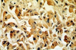 Tenascin-X Rabbit anti-Human, Mouse, Rat, Polyclonal, Proteintech:Antibodies:Primary