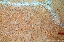 Tenascin-X Rabbit anti-Human, Mouse, Rat, Polyclonal, Proteintech:Antibodies:Primary