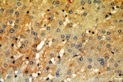 Tenascin-X Rabbit anti-Human, Mouse, Rat, Polyclonal, Proteintech:Antibodies:Primary