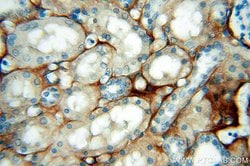Tenascin-X Rabbit anti-Human, Mouse, Rat, Polyclonal, Proteintech:Antibodies:Primary