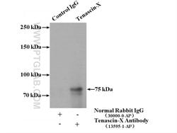 Tenascin-X Rabbit anti-Human, Mouse, Rat, Polyclonal, Proteintech:Antibodies:Primary