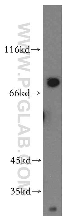 Tenascin-X Rabbit anti-Human, Mouse, Rat, Polyclonal, Proteintech:Antibodies:Primary