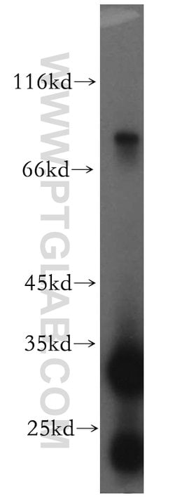 Tenascin-X Rabbit anti-Human, Mouse, Rat, Polyclonal, Proteintech:Antibodies:Primary
