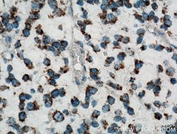 Carboxypeptidase A6 Rabbit anti-Human, Mouse, Rat, Polyclonal, Proteintech