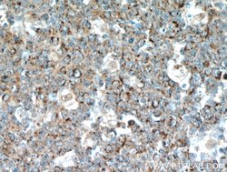 FBXO22 Rabbit anti-Human, Polyclonal, Proteintech:Anticuerpos:Anticuerpos