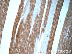 TOB2 Rabbit anti-Human, Mouse, Rat, Polyclonal, Proteintech:Antibodies:Primary