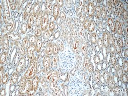 TOB2 Rabbit anti-Human, Mouse, Rat, Polyclonal, Proteintech:Antibodies:Primary