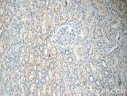 TOB2 Rabbit anti-Human, Mouse, Rat, Polyclonal, Proteintech:Antibodies:Primary