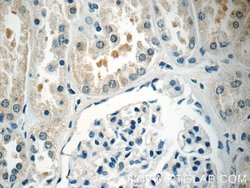 TOB2 Rabbit anti-Human, Mouse, Rat, Polyclonal, Proteintech:Antibodies:Primary