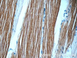 TOB2 Rabbit anti-Human, Mouse, Rat, Polyclonal, Proteintech:Antibodies:Primary