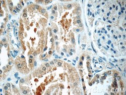TOB2 Rabbit anti-Human, Mouse, Rat, Polyclonal, Proteintech:Antibodies:Primary