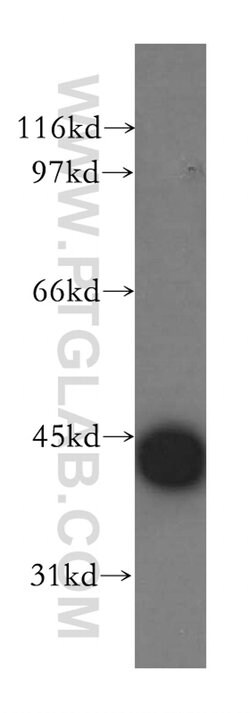 CAMK1D Rabbit anti-Human, Mouse, Rat, Polyclonal, Proteintech:Antibodies:Primary