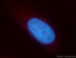MLXIP Rabbit anti-Human, Mouse, Rat, Polyclonal, Proteintech:Antibodies:Primary