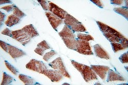 MLXIP Rabbit anti-Human, Mouse, Rat, Polyclonal, Proteintech:Antibodies:Primary
