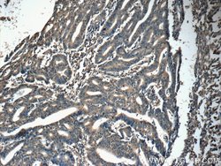 IFT20 Rabbit anti-Canine, Human, Mouse, Polyclonal, Proteintech 150 &mu;L;