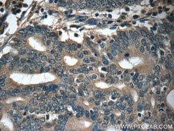 IFT20 Rabbit anti-Canine, Human, Mouse, Polyclonal, Proteintech 150 &mu;L;