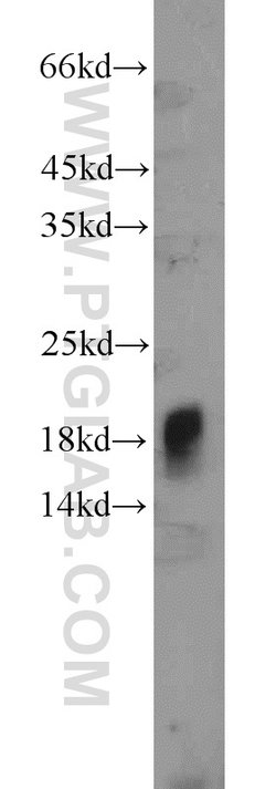 IFT20 Rabbit anti-Canine, Human, Mouse, Polyclonal, Proteintech 150 &mu;L;