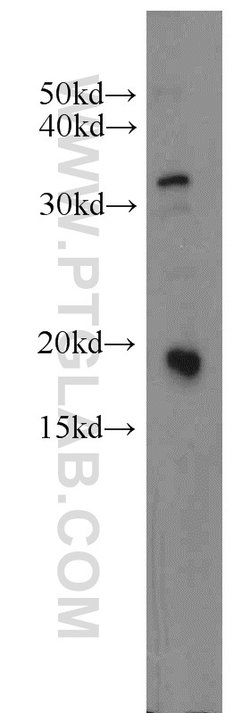 IFT20 Rabbit anti-Canine, Human, Mouse, Polyclonal, Proteintech 150 &mu;L;