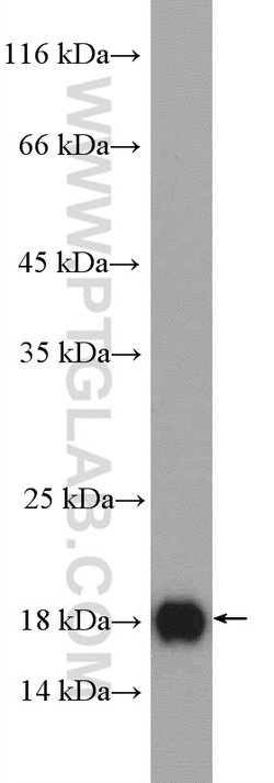 IFT20 Rabbit anti-Canine, Human, Mouse, Polyclonal, Proteintech 150 &mu;L;