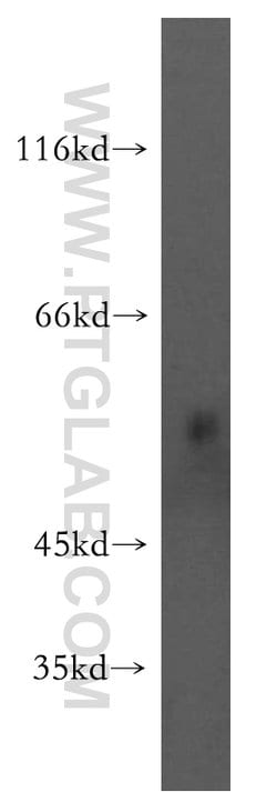 RASGEF1B Rabbit anti-Human, Mouse, Rat, Polyclonal, Proteintech 150 &mu;L;