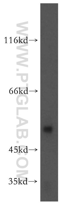 RASGEF1B Rabbit anti-Human, Mouse, Rat, Polyclonal, Proteintech 150 &mu;L;