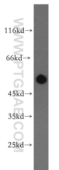 RASGEF1B Rabbit anti-Human, Mouse, Rat, Polyclonal, Proteintech 150 &mu;L;