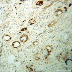 SERCA3 Rabbit anti-Human, Mouse, Rat, Polyclonal, Proteintech:Antibodies:Primary
