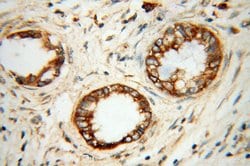 SERCA3 Rabbit anti-Human, Mouse, Rat, Polyclonal, Proteintech:Antibodies:Primary