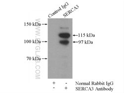 SERCA3 Rabbit anti-Human, Mouse, Rat, Polyclonal, Proteintech:Antibodies:Primary