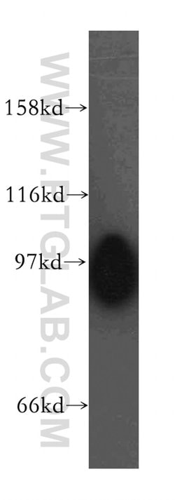 SERCA3 Rabbit anti-Human, Mouse, Rat, Polyclonal, Proteintech:Antibodies:Primary