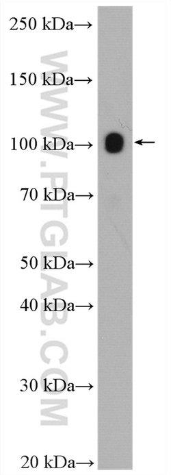SERCA3 Rabbit anti-Human, Mouse, Rat, Polyclonal, Proteintech:Antibodies:Primary