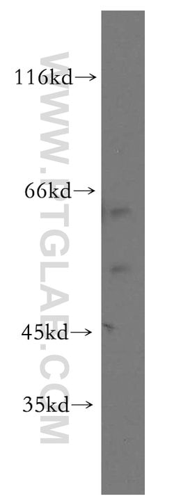 ST3GAL2 Rabbit anti-Human, Mouse, Rat, Polyclonal, Proteintech 150 &mu;L;
