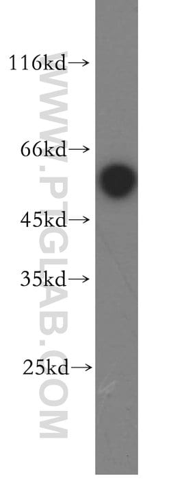 ST3GAL2 Rabbit anti-Human, Mouse, Rat, Polyclonal, Proteintech 150 &mu;L;