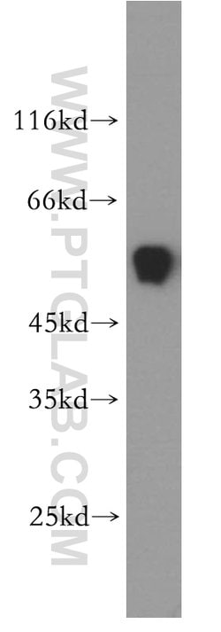 ST3GAL2 Rabbit anti-Human, Mouse, Rat, Polyclonal, Proteintech 150 &mu;L;