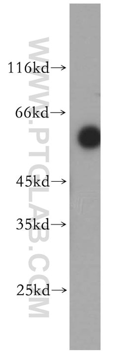 ST3GAL2 Rabbit anti-Human, Mouse, Rat, Polyclonal, Proteintech 150 &mu;L;