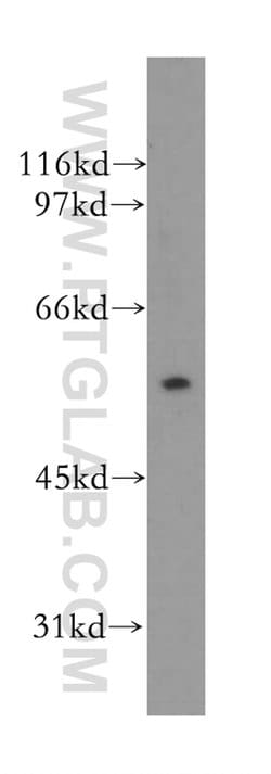 TRIM15 Rabbit anti-Human, Mouse, Polyclonal, Proteintech:Antibodies:Primary