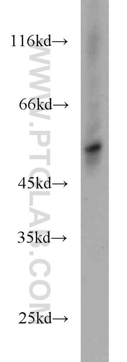 TRIM15 Rabbit anti-Human, Mouse, Polyclonal, Proteintech:Antibodies:Primary