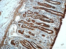 CAMKK1 Rabbit anti-Human, Mouse, Rat, Polyclonal, Proteintech 150 &mu;L;