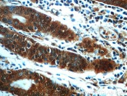 CAMKK1 Rabbit anti-Human, Mouse, Rat, Polyclonal, Proteintech 150 &mu;L;