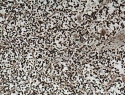CAMKK1 Rabbit anti-Human, Mouse, Rat, Polyclonal, Proteintech 150 &mu;L;