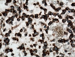 CAMKK1 Rabbit anti-Human, Mouse, Rat, Polyclonal, Proteintech 150 &mu;L;