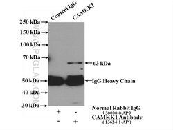 CAMKK1 Rabbit anti-Human, Mouse, Rat, Polyclonal, Proteintech 150 &mu;L;