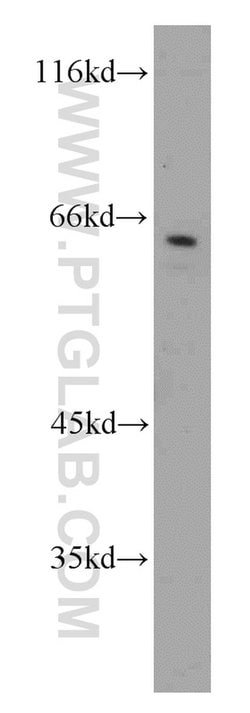 CAMKK1 Rabbit anti-Human, Mouse, Rat, Polyclonal, Proteintech 150 &mu;L;