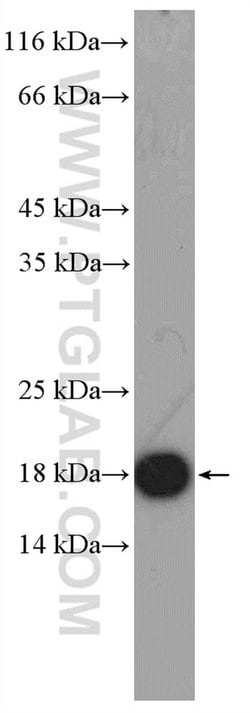 GMFG Rabbit anti-Human, Mouse, Rat, Polyclonal, Proteintech 150 &mu;L;