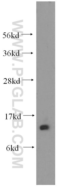 FABP1 Rabbit anti-Human, Mouse, Rat, Polyclonal, Proteintech:Antibodies:Primary