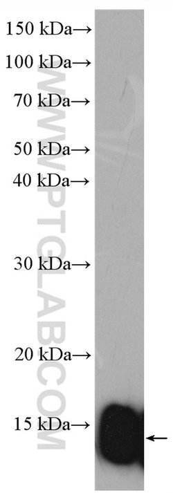 FABP1 Rabbit anti-Human, Mouse, Rat, Polyclonal, Proteintech:Antibodies:Primary