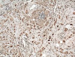 RALA Rabbit anti-Human, Mouse, Rat, Polyclonal, Proteintech:Antibodies:Primary