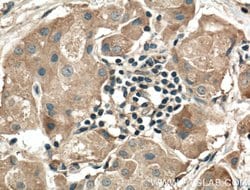 RALA Rabbit anti-Human, Mouse, Rat, Polyclonal, Proteintech:Antibodies:Primary