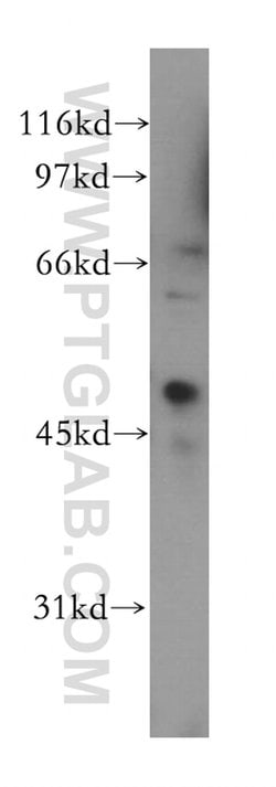 CREB3L4 Rabbit anti-Human, Polyclonal, Proteintech 150 &mu;L; Unconjugated:Antibodies,