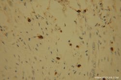 POLI Rabbit anti-Human, Mouse, Rat, Polyclonal, Proteintech 150 &mu;L;